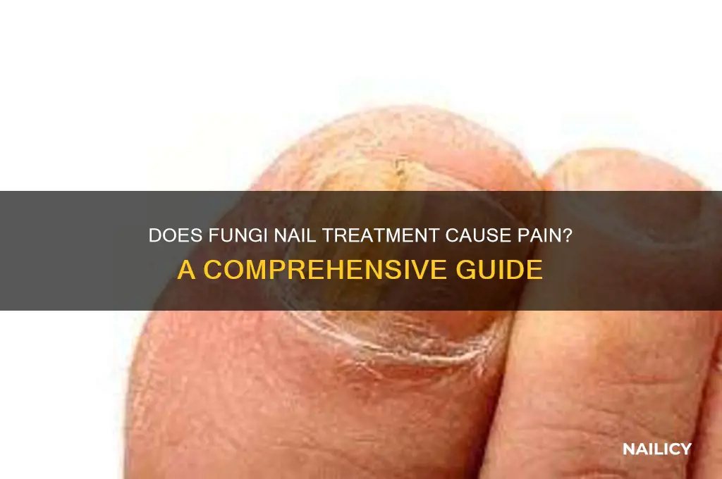 does fungi nail hurt