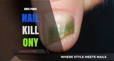 Does Fungi-Nail Effectively Treat Onycho-mycosis? A Comprehensive Review