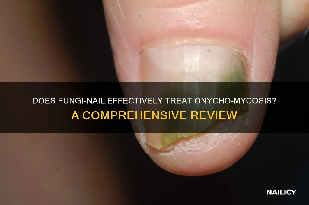 does fungi nail kill ony