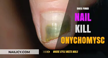Fungi Nail vs. Onychomycosis: Effective Treatment or Just a Myth?