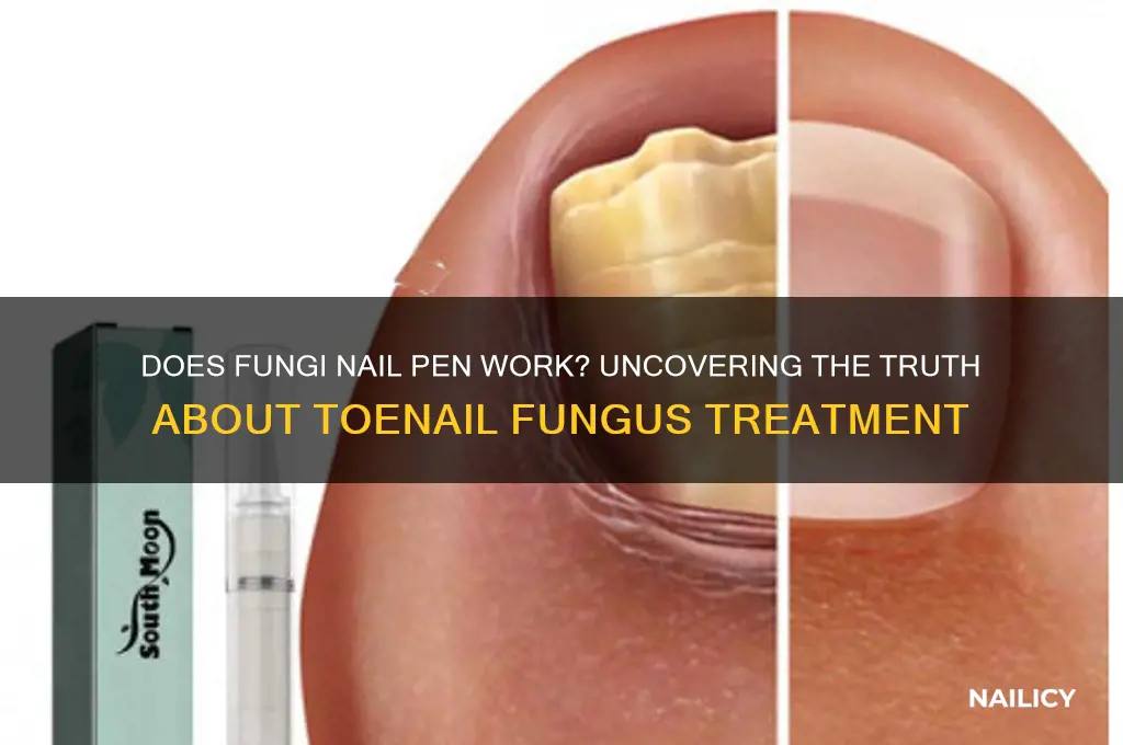 does fungi nail pen work