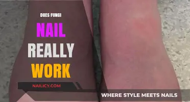 Does Fungi Nail Really Work? Uncovering the Truth About Toenail Fungus Treatments