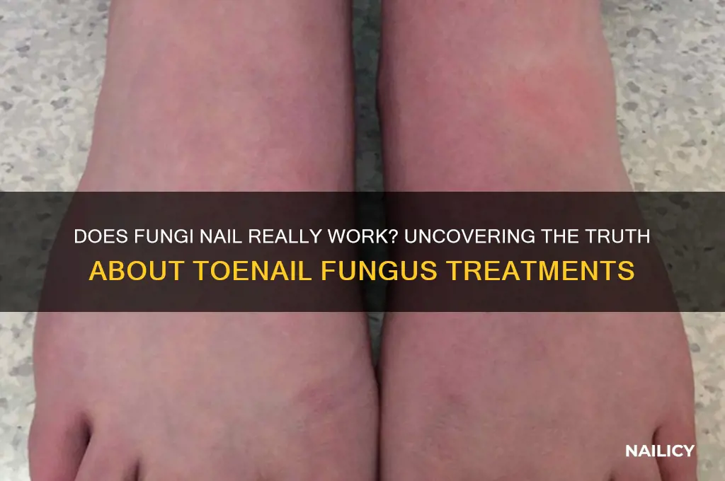 does fungi nail really work