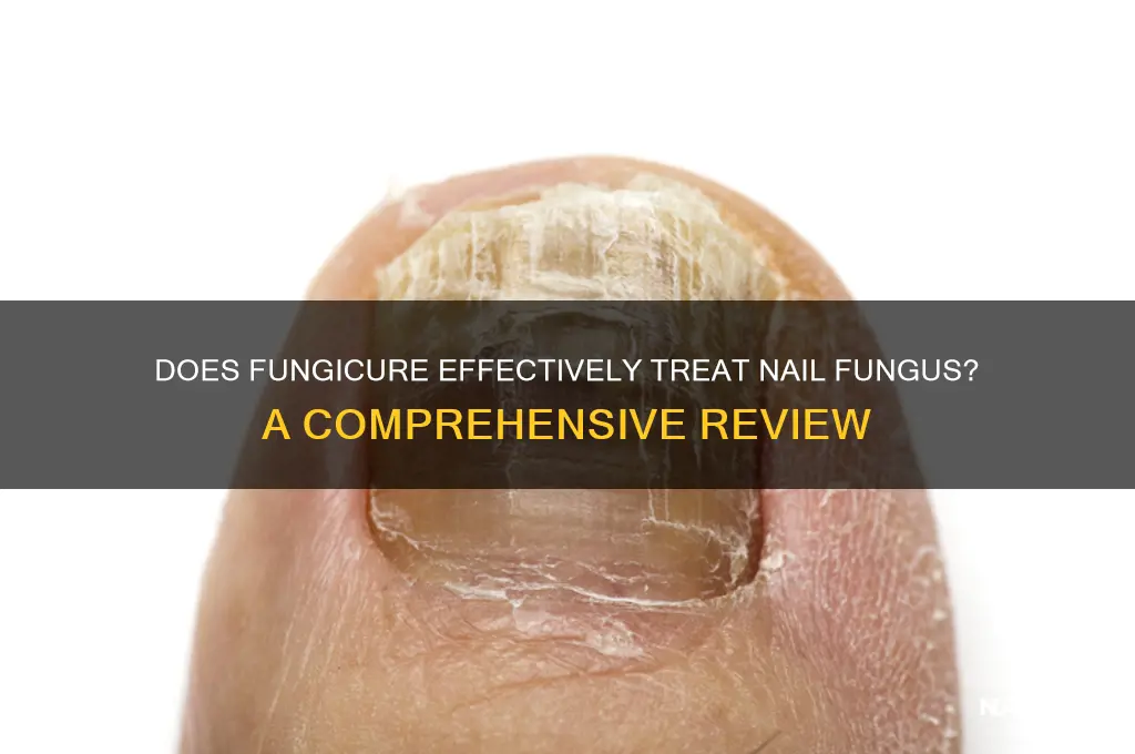 does fungicure work on nails