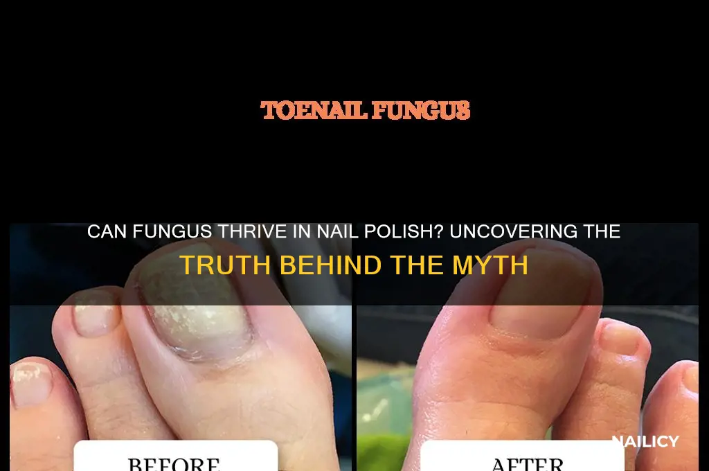 does fungus grow in nail polish