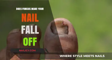 Can Fungal Infections Cause Toenails to Fall Off? Expert Insights
