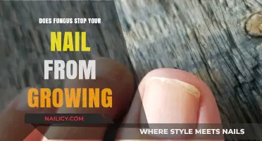 Fungus and Nails: The Growth Connection