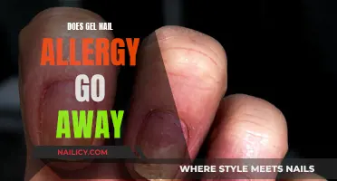 Gel Nail Allergies: Do Symptoms Subside?