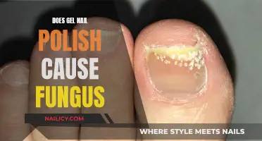 Gel Nail Polish: Friend or Fungal Foe?