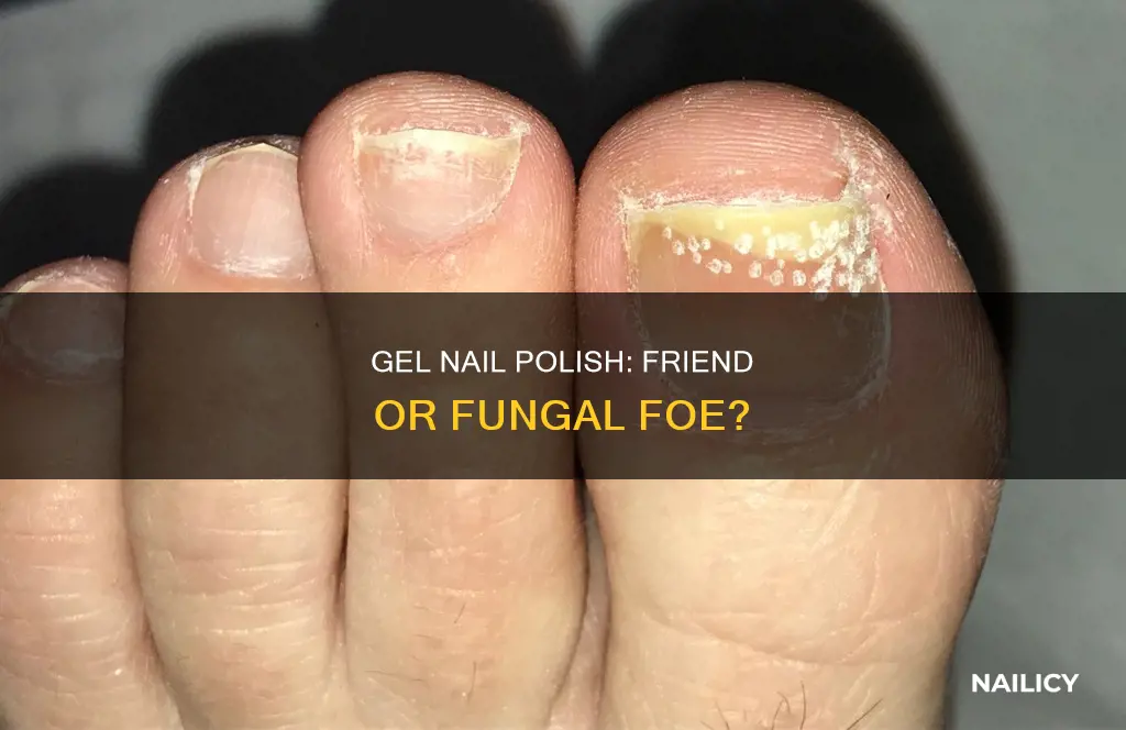 does gel nail polish cause fungus