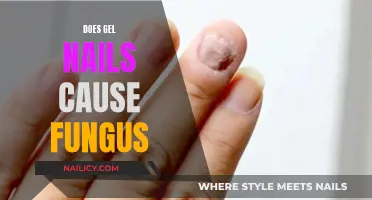 Gel Nails: Friend or Foe in Nail Fungus?