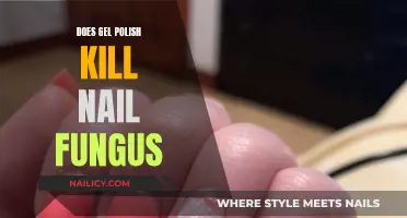 Gel Polish: Friend or Foe to Nail Fungus?