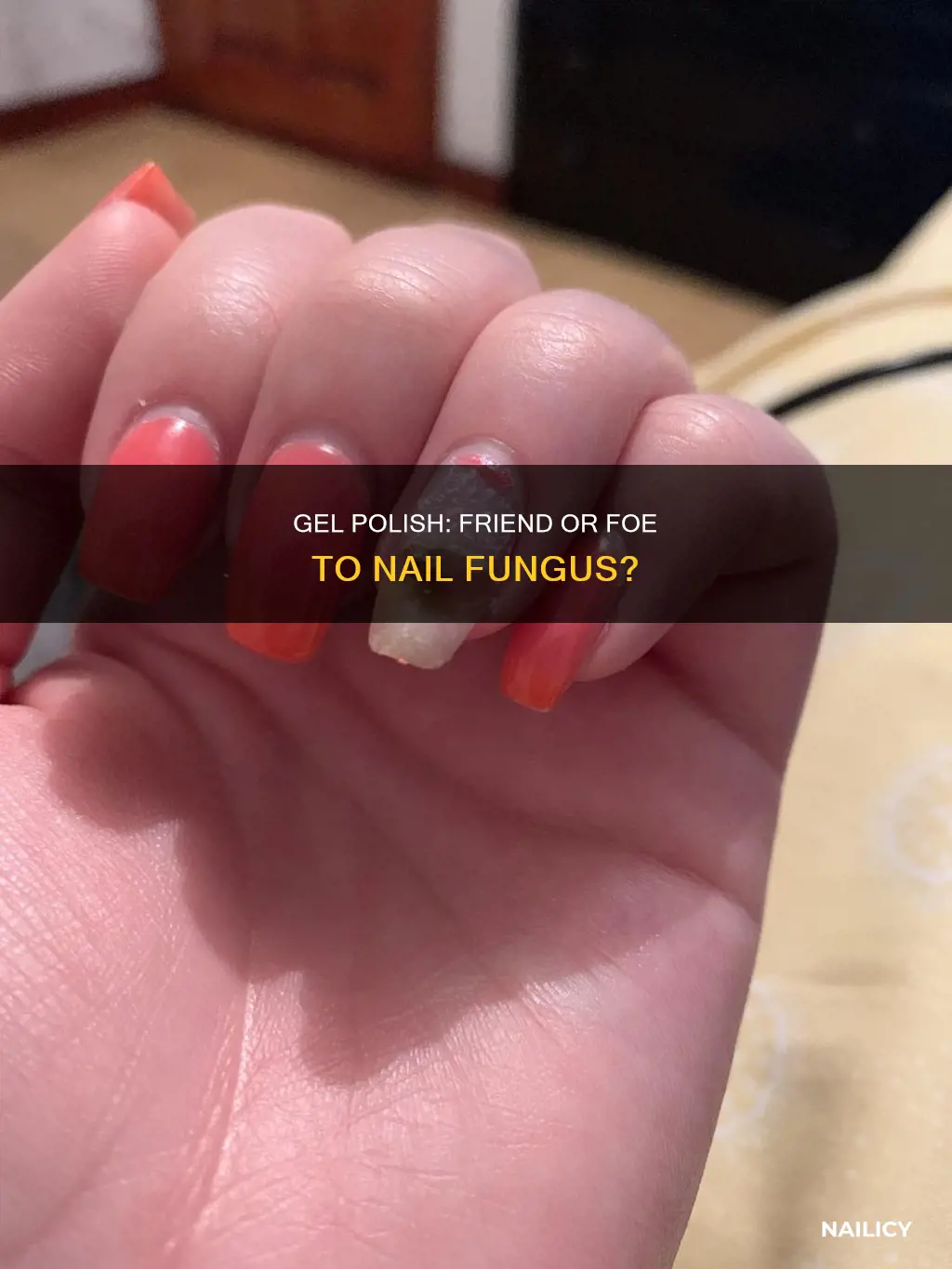 does gel polish kill nail fungus
