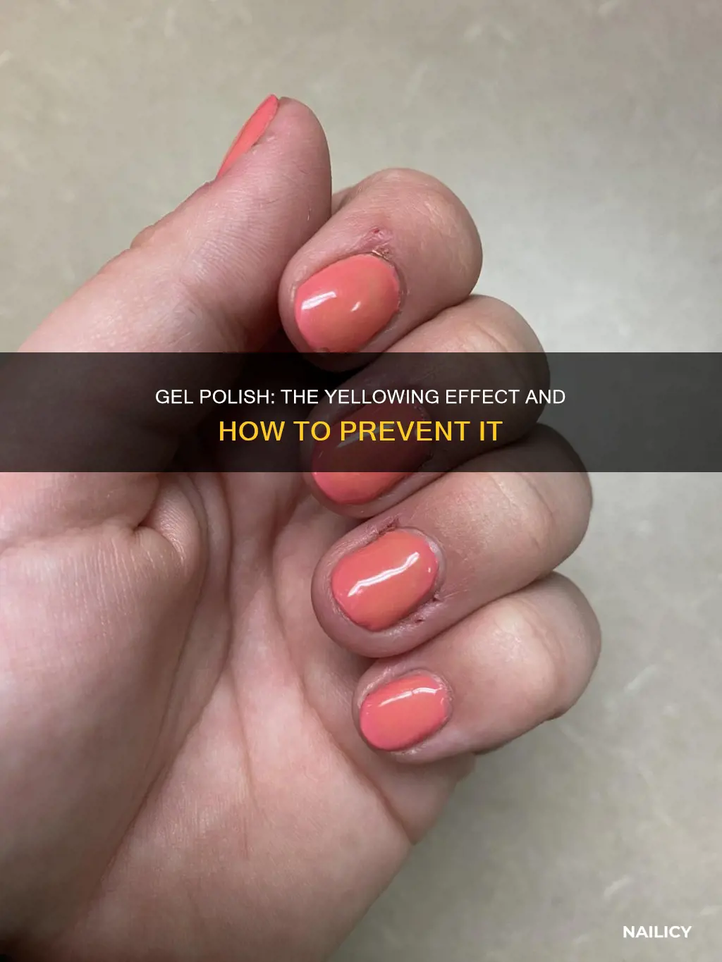 does gel polish make your nails yellow