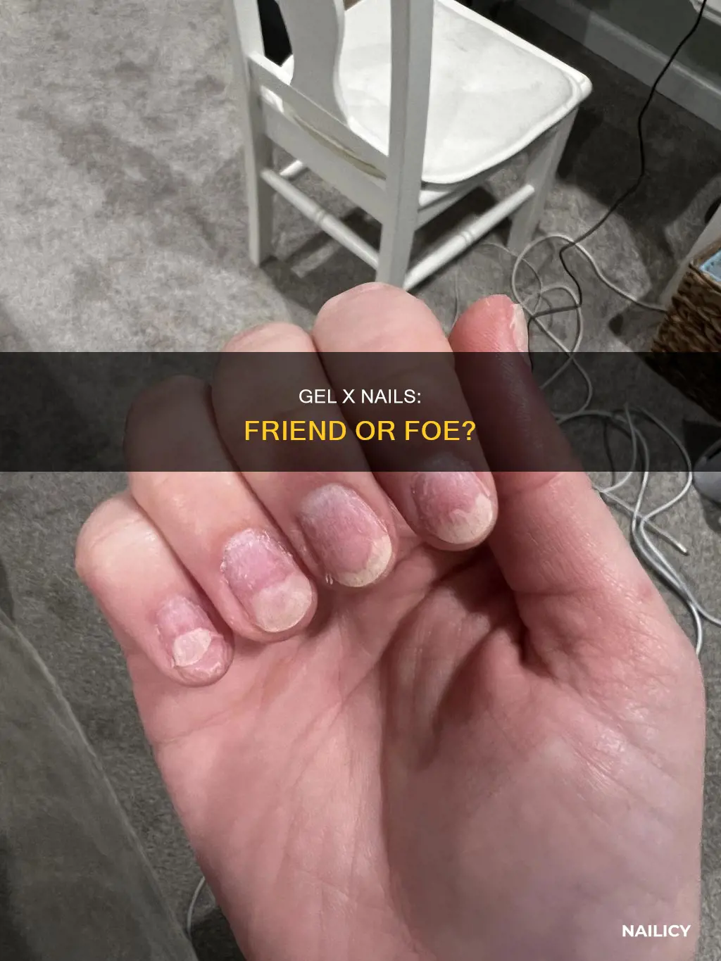 does gel x ruin nails