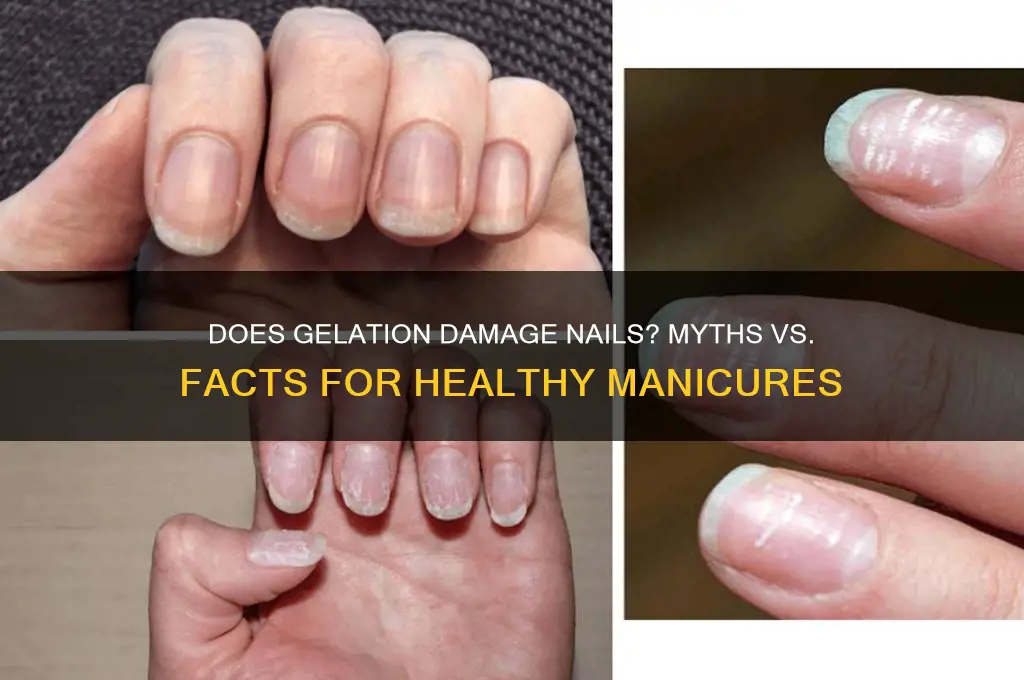 does geleration ruin your nails