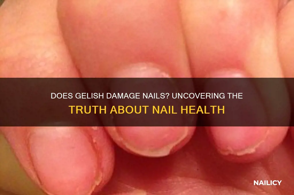does gelish damage nails