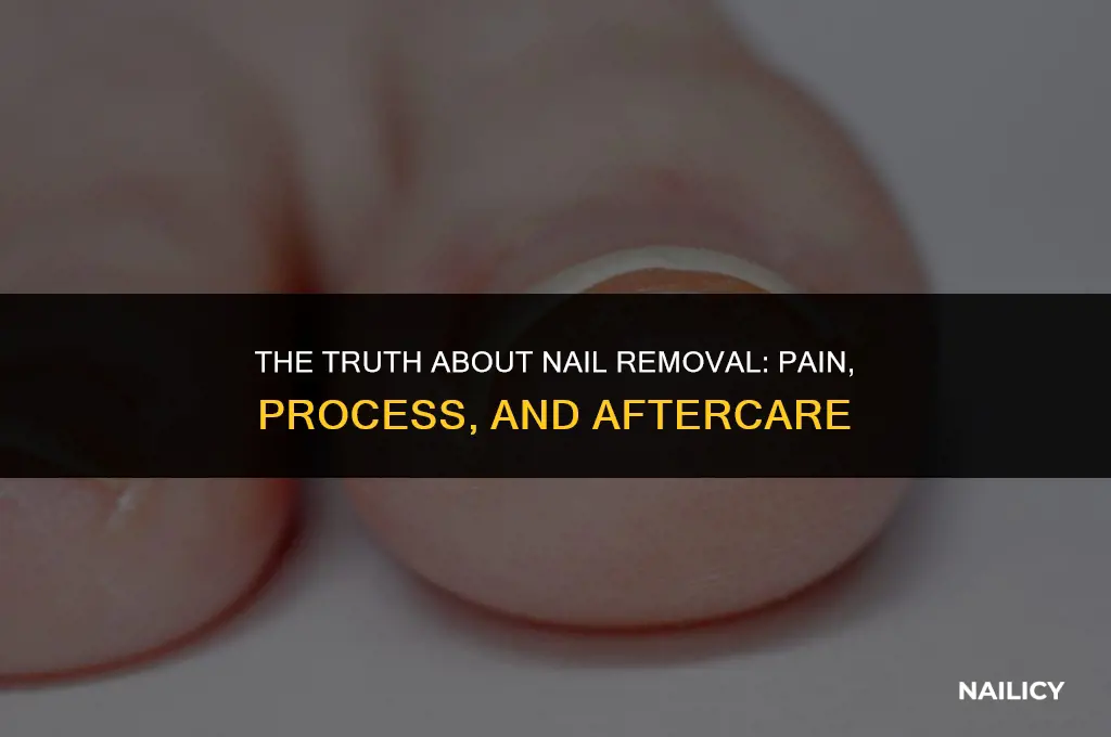 does getting a nail removed hurt