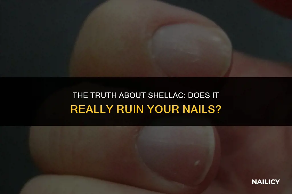 does getting shellac ruin your nails