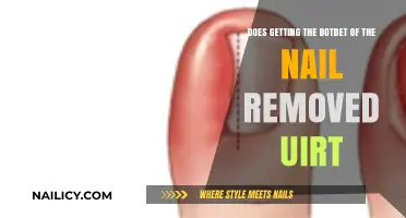 Understanding Ingrown Toenails: Debunking Myths About Nail Removal