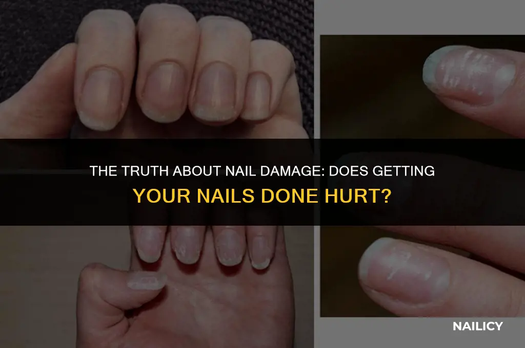 does getting your nails done damage them
