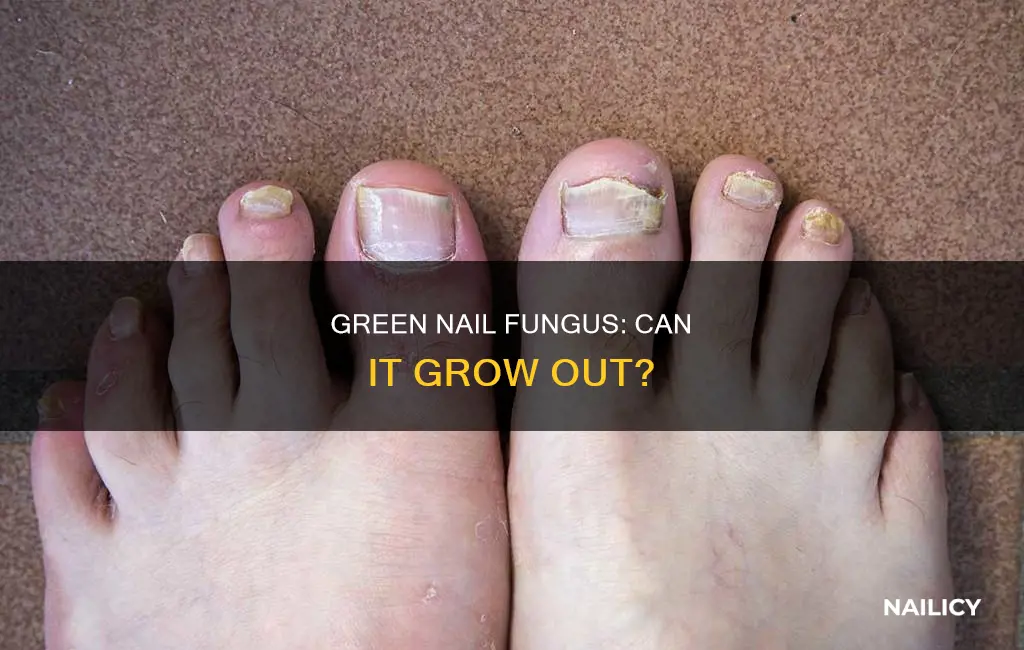 does green nail fungus grow out