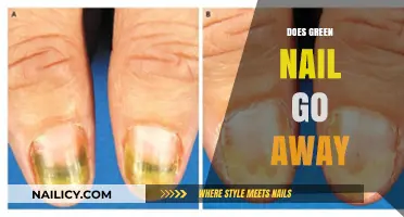 Does Green Nail Go Away? Causes, Treatments, and Prevention Tips