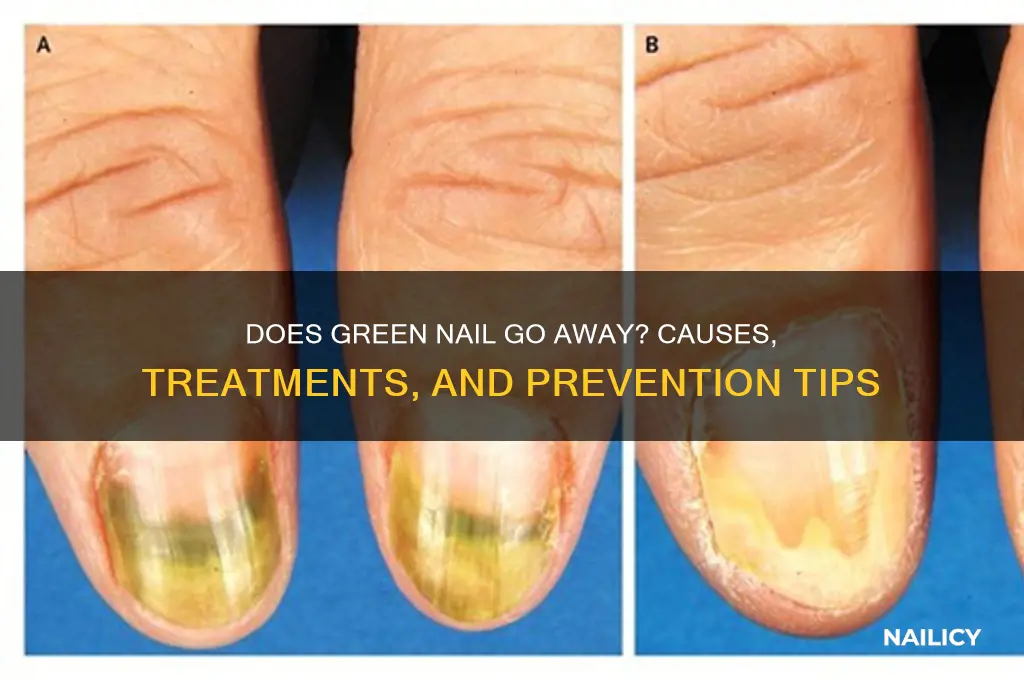 does green nail go away