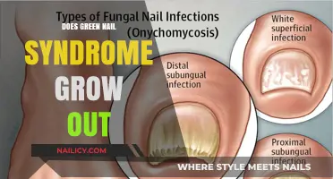 Green Nail Syndrome: Can It Grow Out?
