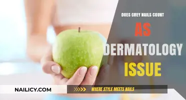 Grey Nails: A Dermatology Concern or Cosmetic Issue?