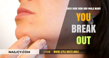 Does Hair, Skin, and Nails Supplement Cause Acne Breakouts?