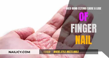 Hand Eczema and Fingernails: What's the Connection?