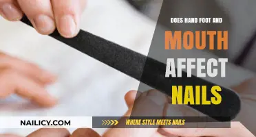 Hand, Foot, and Mouth Disease: Nail Impact and Recovery Explained