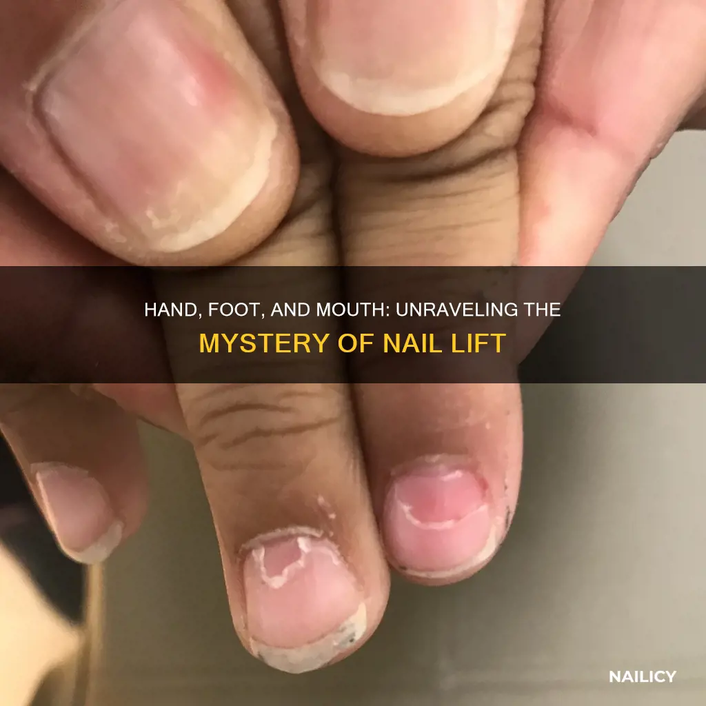 does hand foot and mouth cause finger nails to lift