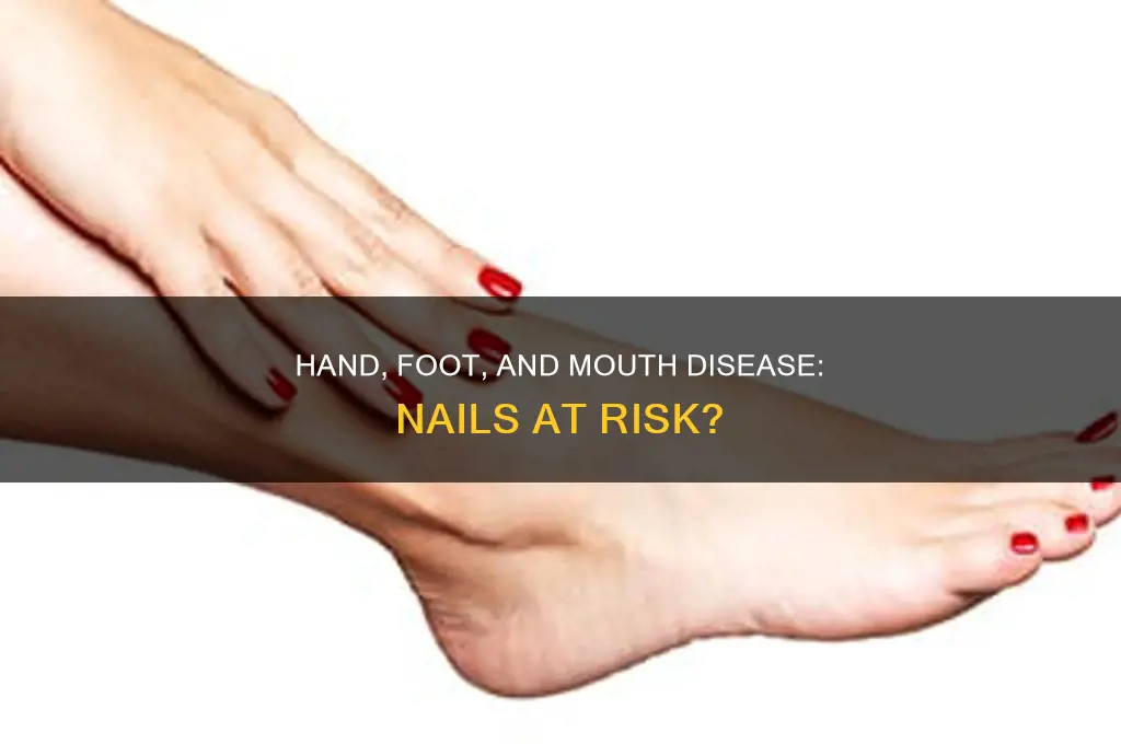 does hand foot and mouth make your nails fall off