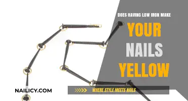 Low Iron and Yellow Nails: Uncovering the Surprising Connection