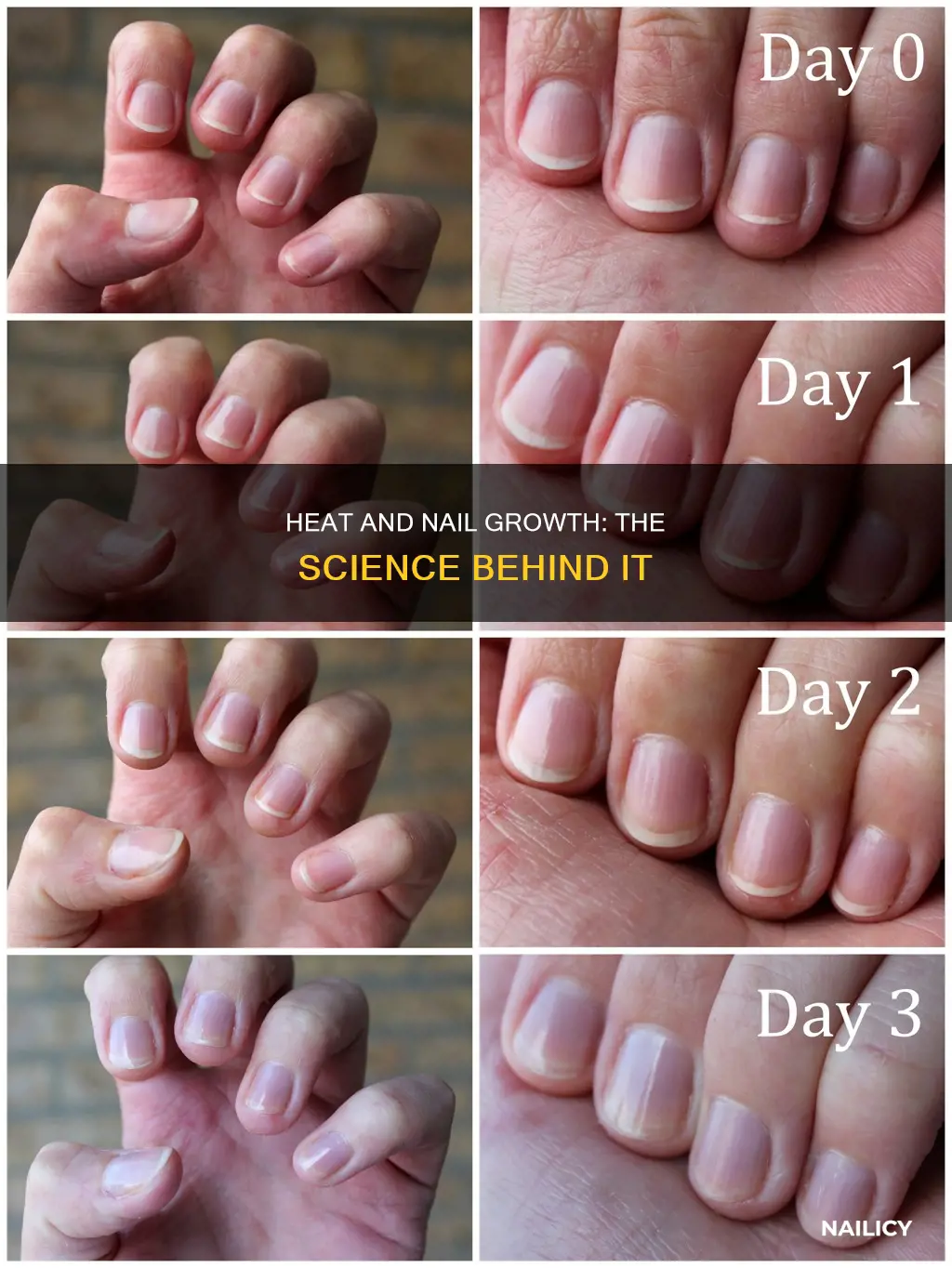 does heat make nails grow faster