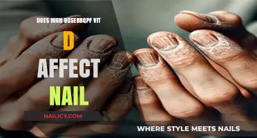 High-Dose Vitamin D: Uncovering Its Impact on Nail Health
