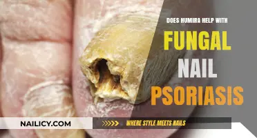 Humira for Fungal Nail Psoriasis: Effective Treatment or Myth?