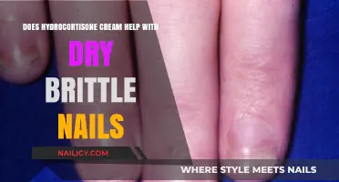 Hydrocortisone Cream for Dry Brittle Nails: Effective Solution or Myth?