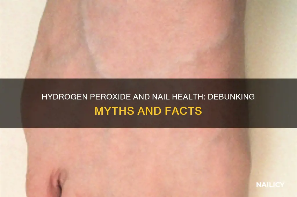 does hydrogen peroxide damage nails