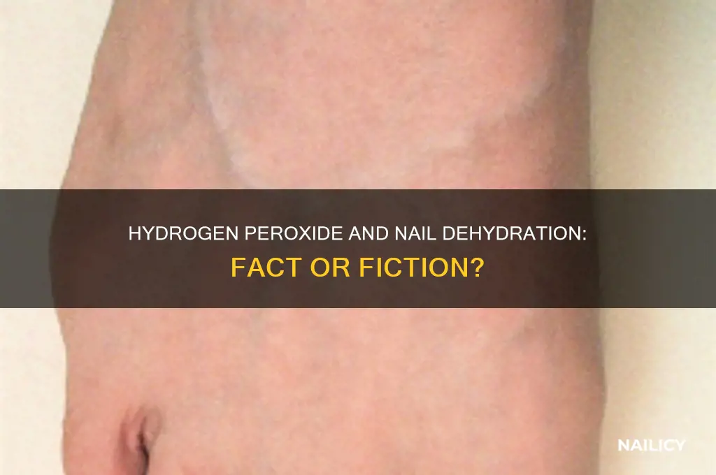 does hydrogen peroxide dehydrate nails