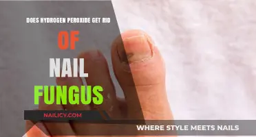 Hydrogen Peroxide: A Natural Remedy for Nail Fungus?