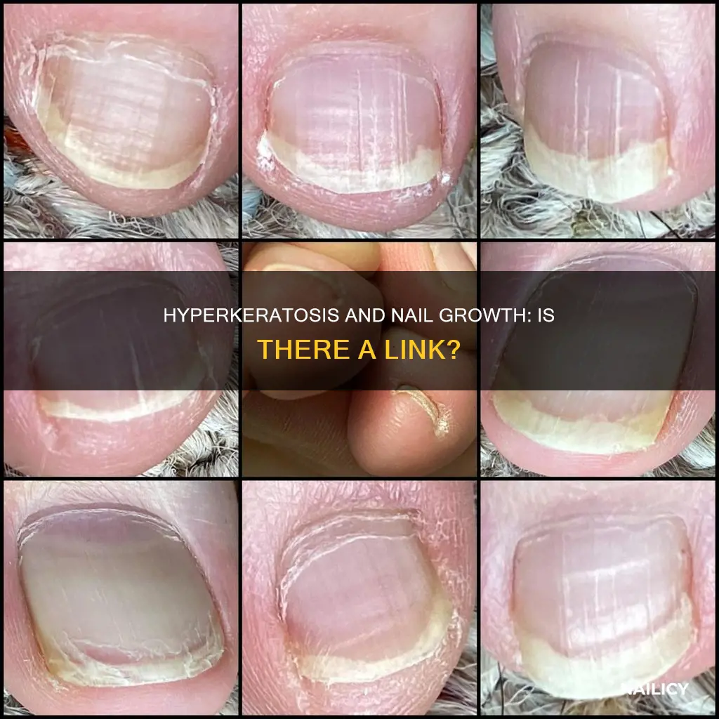 does hyperkeratosis cause nails to grow quickly