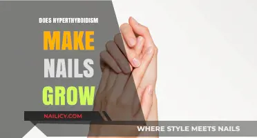 Hyperthyroidism and Nail Growth: Is There a Connection?