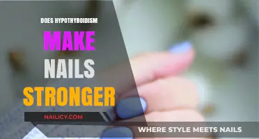 Hypothyroidism and Nail Health: Stronger or Weaker? Unraveling the Truth