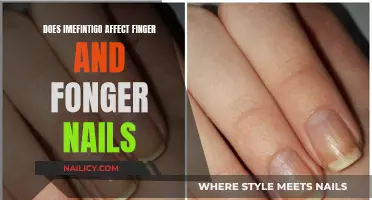 Imefinigito's Impact: Unveiling the Mystery of Finger and Toenail Changes