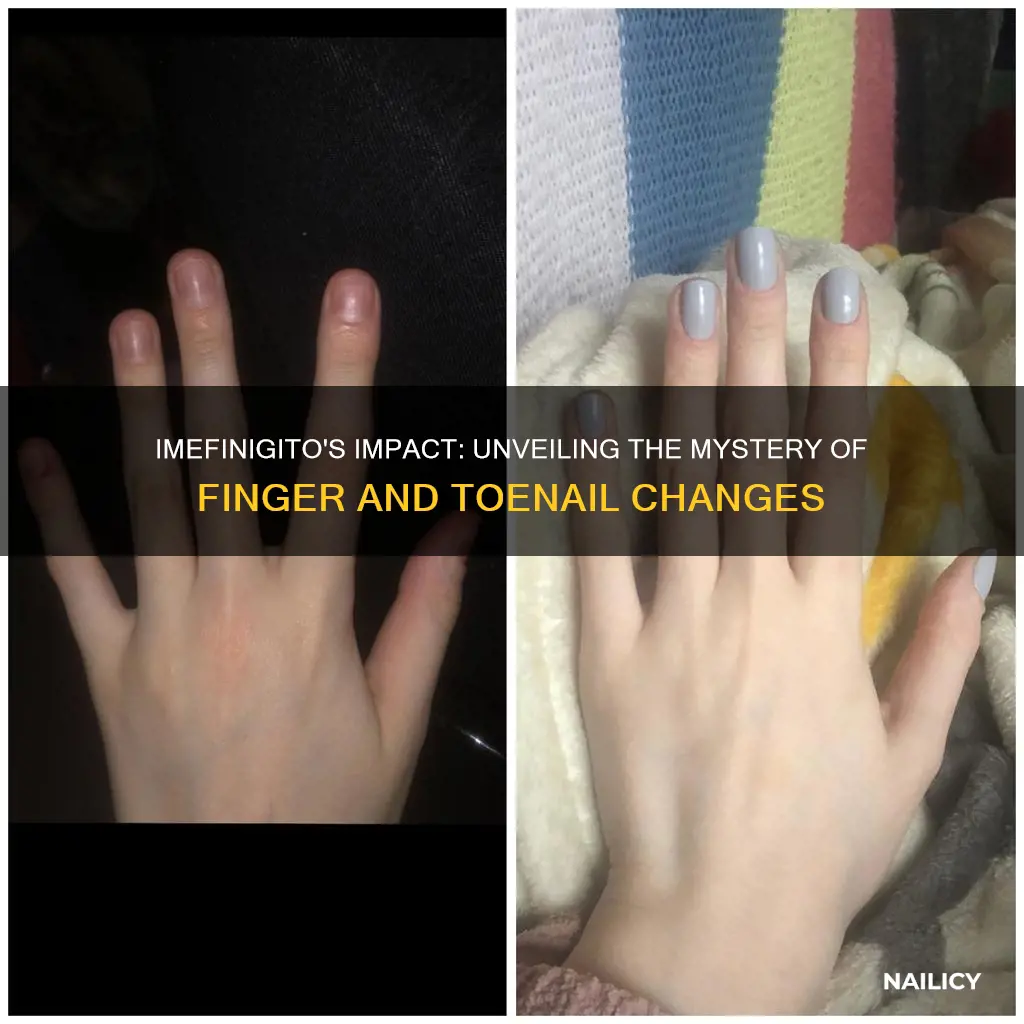 does imefintigo affect finger and fonger nails