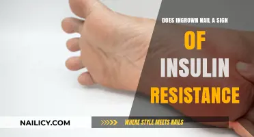Ingrown Nails and Insulin Resistance: Uncovering a Surprising Connection
