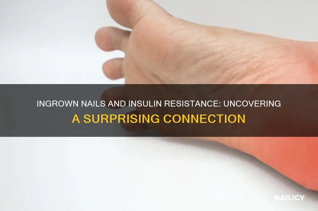 does ingrown nail a sign of insulin resistance